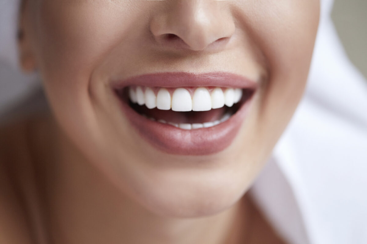 Closeup of Smile with Beautiful Teeth