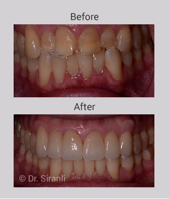 slider12-group-2